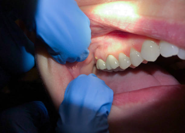 Best 24-Hour Emergency Dentist in Ames, TX