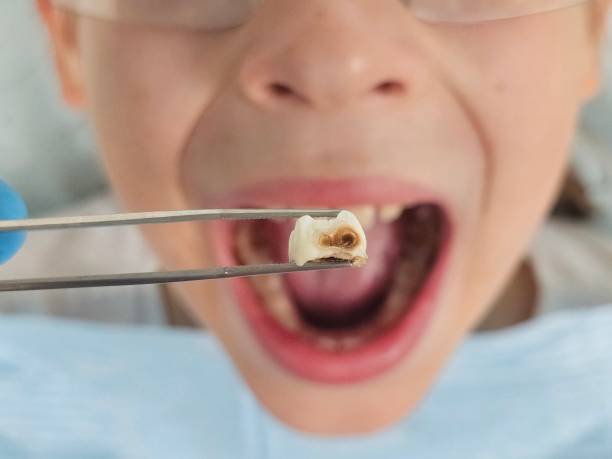 Best Emergency Dentist for Special Needs Patients in Ames, TX